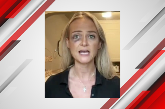 Reporter Katie Daviscourt Assaulted by Portland Antifa, No Arrests Yet